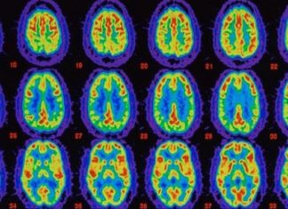 This is What Happens to Your Brain When You Experience Complete Silence