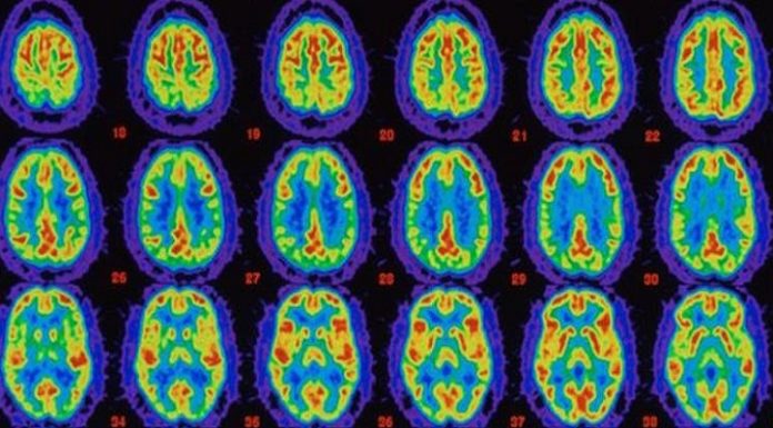 This is What Happens to Your Brain When You Experience Complete Silence