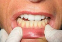 What Happens To Your Teeth When You Brush with Sea Salt and Baking Soda?