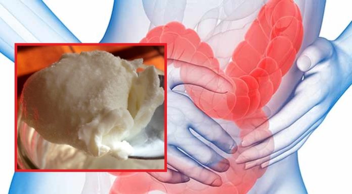 Medical Researchers Stunned — One of the World’s Most Simple Foods Reversed IBS In Almost 90% of All Patients