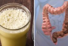 Cleansing Of The Colon Only Drinking This Mixture Is Very Easy
