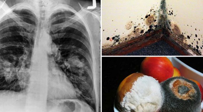How to Reduce and Treat Toxic Mold Exposure in Your Everyday Life