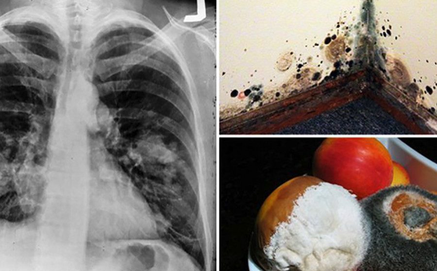 How to Reduce and Treat Toxic Mold Exposure in Your Everyday Life