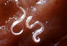 These Herbs Naturally Rid Your Body of Internal Parasites