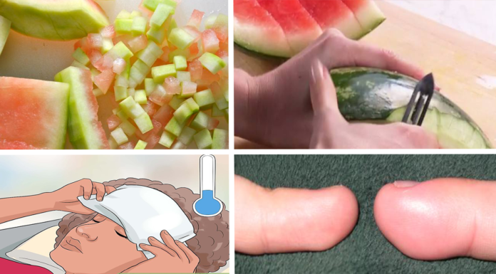 Don’t Throw Away The Watermelon Rind. Make These Rejuvenating Remedies