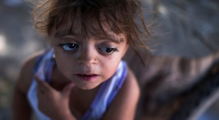 Is Argentina the New Vietnam? New Study Links Monsanto Chemical to Miscarriages, Epidemic of Birth Defects