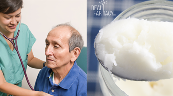 Coconut Oil for Reversing Alzheimer’s Disease Now Clinically Studied