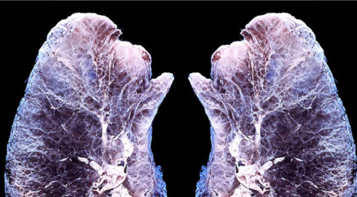 This Is What Happens to Your Lungs When You Diffuse Essential Oils