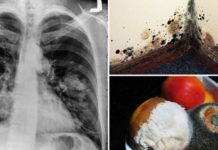 How to Reduce and Treat Toxic Mold Exposure in Your Everyday Life