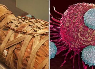 Cancer is a Purely “Man-Made Disease,” British Researchers Suggest After Examining Egyptian Mummies