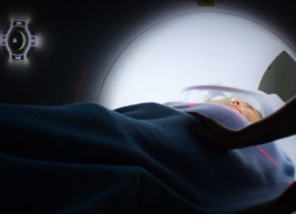 Mesothelioma MRI